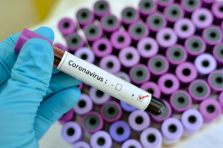 Jak długo potrwa pandemia koronawirusa?